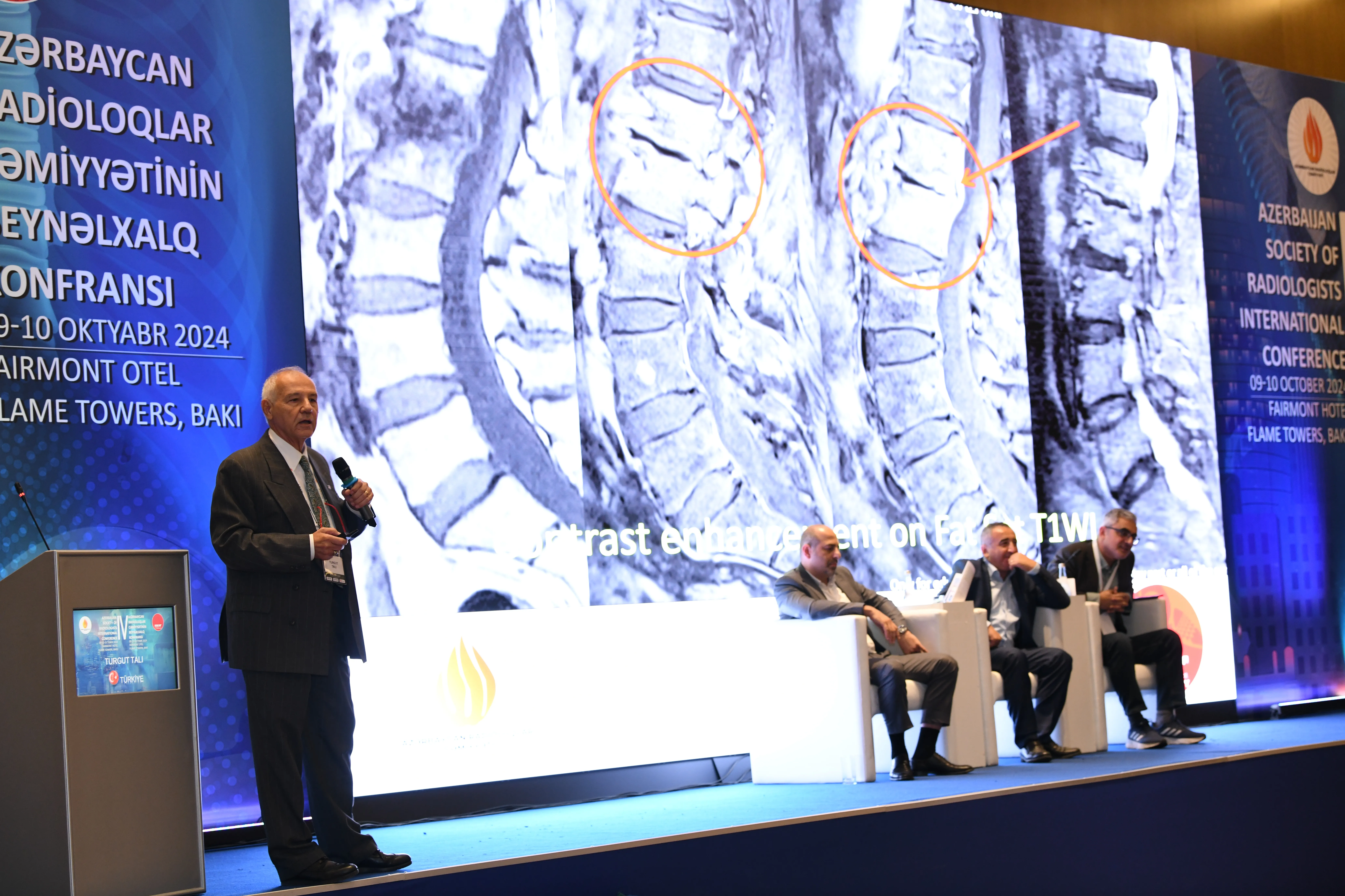 Diaqnoz Tibb Mərkəzi Azərbaycan Radioloqlar Cəmiyyətinin IV beynəlxalq elmi–praktiki konfransında