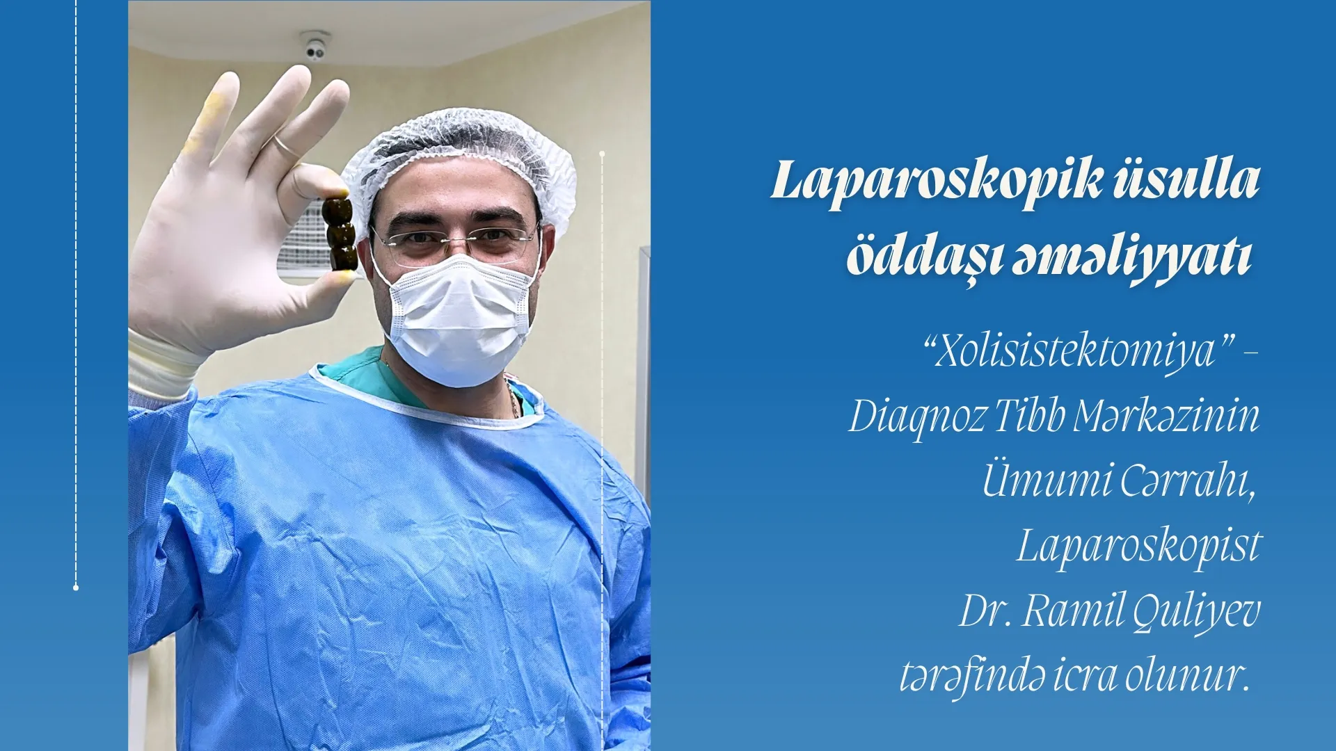 Laparoskopik üsulla Öddaşı əməliyyatı