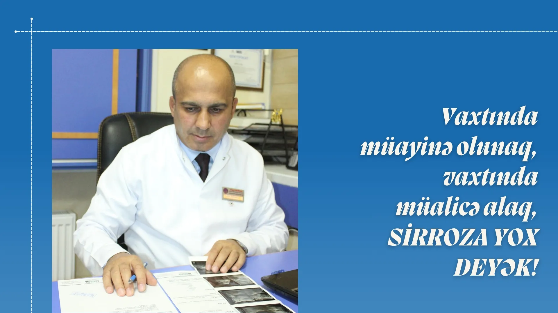 Vaxtında müayinə olunaq, vaxtında müalicə alaq, sirroza yox deyək!